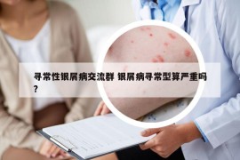 寻常性银屑病交流群 银屑病寻常型算严重吗?
