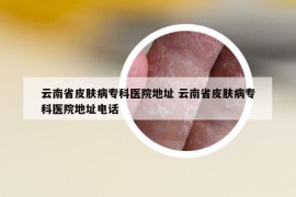 云南省皮肤病专科医院地址 云南省皮肤病专科医院地址电话