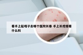 看手上起嘎子去哪个医院长春 手上长疙瘩看什么科