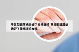 寻常型银屑病治好了能喝酒吗 寻常型银屑病治好了能喝酒吗女性