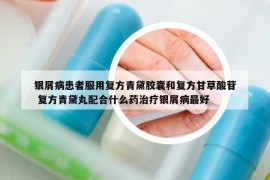 银屑病患者服用复方青黛胶囊和复方甘草酸苷 复方青黛丸配合什么药治疗银屑病最好