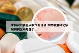 生物制剂和化学制剂的区别 生物制剂和化学制剂的区别是什么