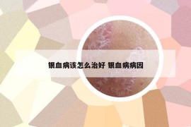 银血病该怎么治好 银血病病因