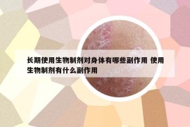 长期使用生物制剂对身体有哪些副作用 使用生物制剂有什么副作用