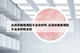 点滴状银屑病轻不治会好吗 点滴状银屑病轻不治会好吗女性