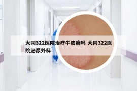 大同322医院治疗牛皮癣吗 大同322医院泌尿外科