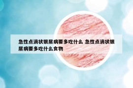 急性点滴状银屑病要多吃什么 急性点滴状银屑病要多吃什么食物