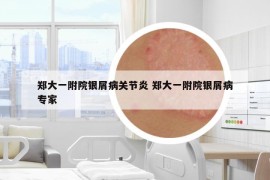 郑大一附院银屑病关节炎 郑大一附院银屑病专家