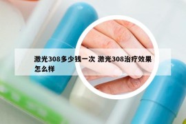 激光308多少钱一次 激光308治疗效果怎么样