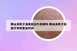 鞍山汤岗子温泉能治牛皮癣吗 鞍山汤岗子温泉疗养院营业时间
