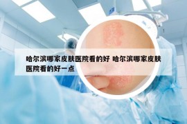 哈尔滨哪家皮肤医院看的好 哈尔滨哪家皮肤医院看的好一点