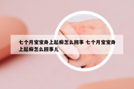 七个月宝宝身上起癣怎么回事 七个月宝宝身上起癣怎么回事儿