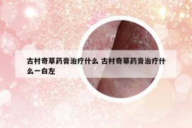 古村奇草药膏治疗什么 古村奇草药膏治疗什么一白左