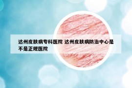 达州皮肤病专科医院 达州皮肤病防治中心是不是正规医院