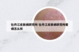 牡丹江皮肤病研究所 牡丹江皮肤病研究所看病怎么样