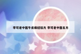 李可老中医牛皮癣经验方 李可老中医名方