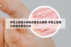手臂上出现小白斑点是怎么回事 手臂上出现小白斑点是怎么办