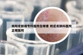 南阳皮肤病专科医院在哪里 附近皮肤科医院正规医院