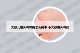 女孩儿眉头有块癣怎么回事 小女孩眉头有痣