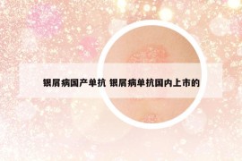 银屑病国产单抗 银屑病单抗国内上市的