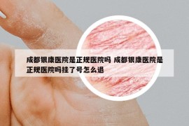 成都银康医院是正规医院吗 成都银康医院是正规医院吗挂了号怎么退