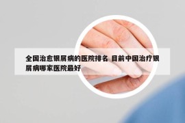 全国治愈银屑病的医院排名 目前中国治疗银屑病哪家医院最好