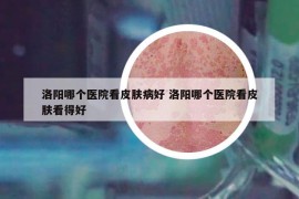 洛阳哪个医院看皮肤病好 洛阳哪个医院看皮肤看得好