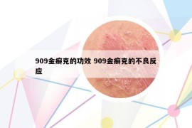 909金癣克的功效 909金癣克的不良反应