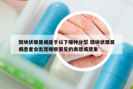 斑块状银屑病属于以下哪种分型 斑块状银屑病患者会出现哪些常见的表现或现象