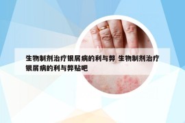 生物制剂治疗银屑病的利与弊 生物制剂治疗银屑病的利与弊贴吧