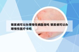 银屑病可以办理慢性病医保吗 银屑病可以办理慢性医疗卡吗