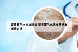 藿香正气水治皮肤病 藿香正气水治皮肤病有哪些方法