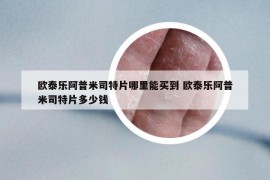 欧泰乐阿普米司特片哪里能买到 欧泰乐阿普米司特片多少钱