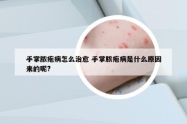 手掌脓疱病怎么治愈 手掌脓疱病是什么原因来的呢?