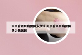 南京看银屑病需要多少钱 南京看银屑病需要多少钱医保