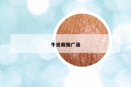 牛皮癣推广语