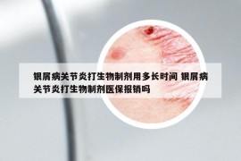 银屑病关节炎打生物制剂用多长时间 银屑病关节炎打生物制剂医保报销吗