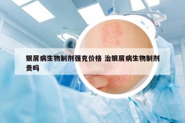 银屑病生物制剂强克价格 治银屑病生物制剂贵吗