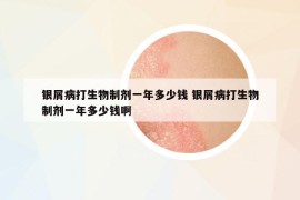 银屑病打生物制剂一年多少钱 银屑病打生物制剂一年多少钱啊