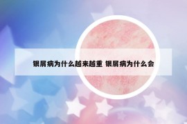 银屑病为什么越来越重 银屑病为什么会