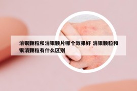消银颗粒和消银颗片哪个效果好 消银颗粒和银消颗粒有什么区别