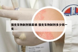 强克生物制剂银屑病 强克生物制剂多少钱一支