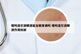 噻吗洛尔滴眼液能治银屑病吗 噻吗洛尔滴眼液作用机制
