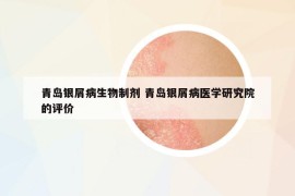 青岛银屑病生物制剂 青岛银屑病医学研究院的评价