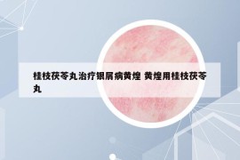 桂枝茯苓丸治疗银屑病黄煌 黄煌用桂枝茯苓丸