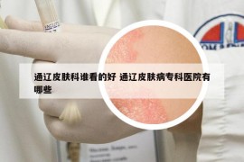 通辽皮肤科谁看的好 通辽皮肤病专科医院有哪些
