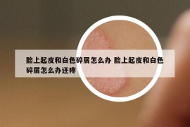 脸上起皮和白色碎屑怎么办 脸上起皮和白色碎屑怎么办还疼
