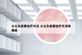 小儿头皮癣治疗方法 小儿头皮癣治疗方法有哪些
