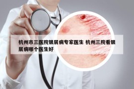杭州市三医院银屑病专家医生 杭州三院看银屑病哪个医生好