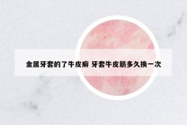 金属牙套的了牛皮癣 牙套牛皮筋多久换一次